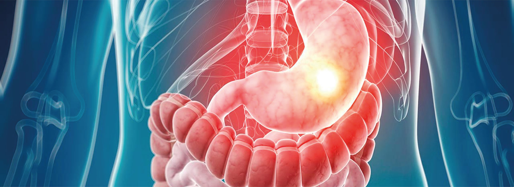 Actualización en gastroenterología para primer nivel de atención