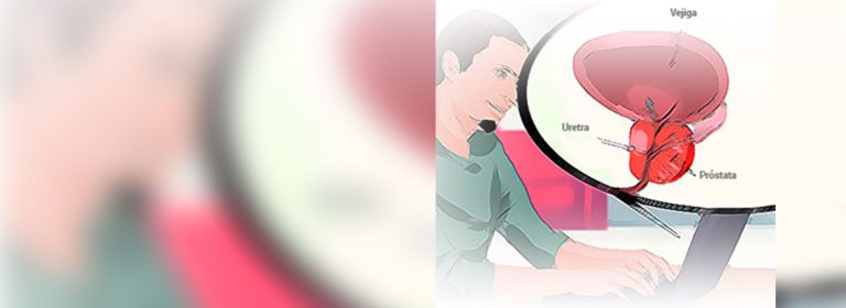 Prevención, diagnóstico y control del cáncer de próstata y otras alteraciones urológicas